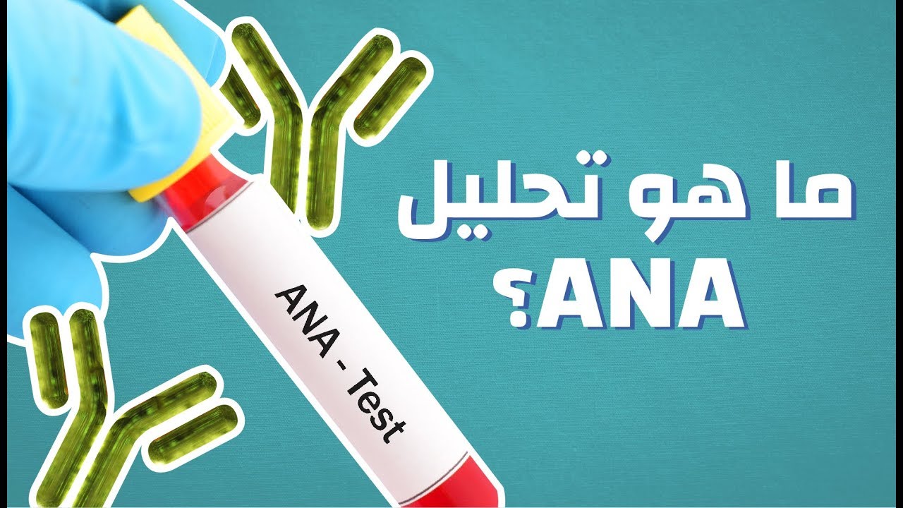 ما هو تحليل ANA , مالمقصود بعمل تحليل الana