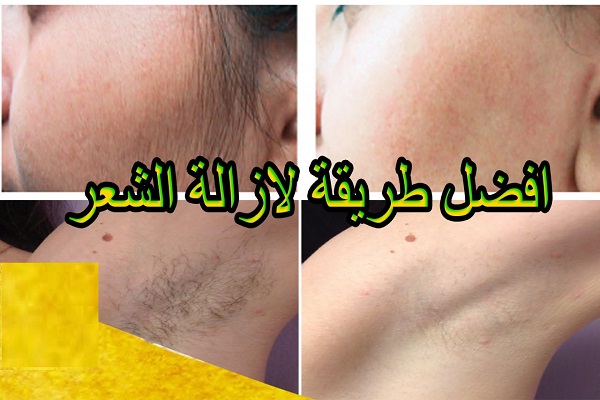 الي متزوجة وتشيل شعر المنطقة الحساسه بالموس تدخل ادخلوا كلكم عشان تستفيدون - طرق ازالة الشعر في المناطق الحساسة 1164